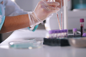 A woman is analyzing a blood in