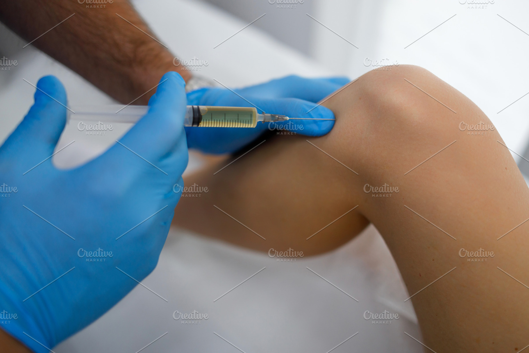 Close up view of orthopedic doctor, a Photo by Andrii Borodai