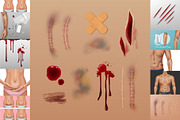 Scars Set, a Healthcare Illustration by Zonda (Thumbnail 1 of 13)