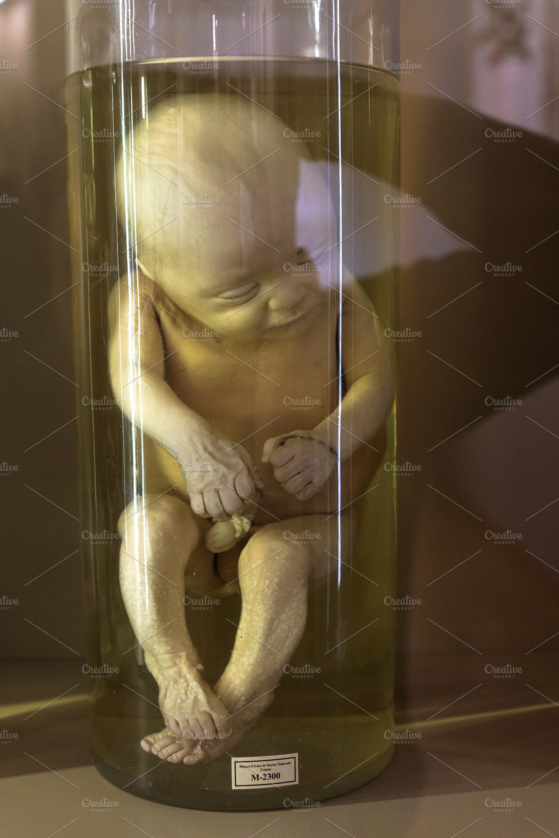 Human fetus 6 th month in glass container with formalin, a School & Education Photo by Bepslabor
