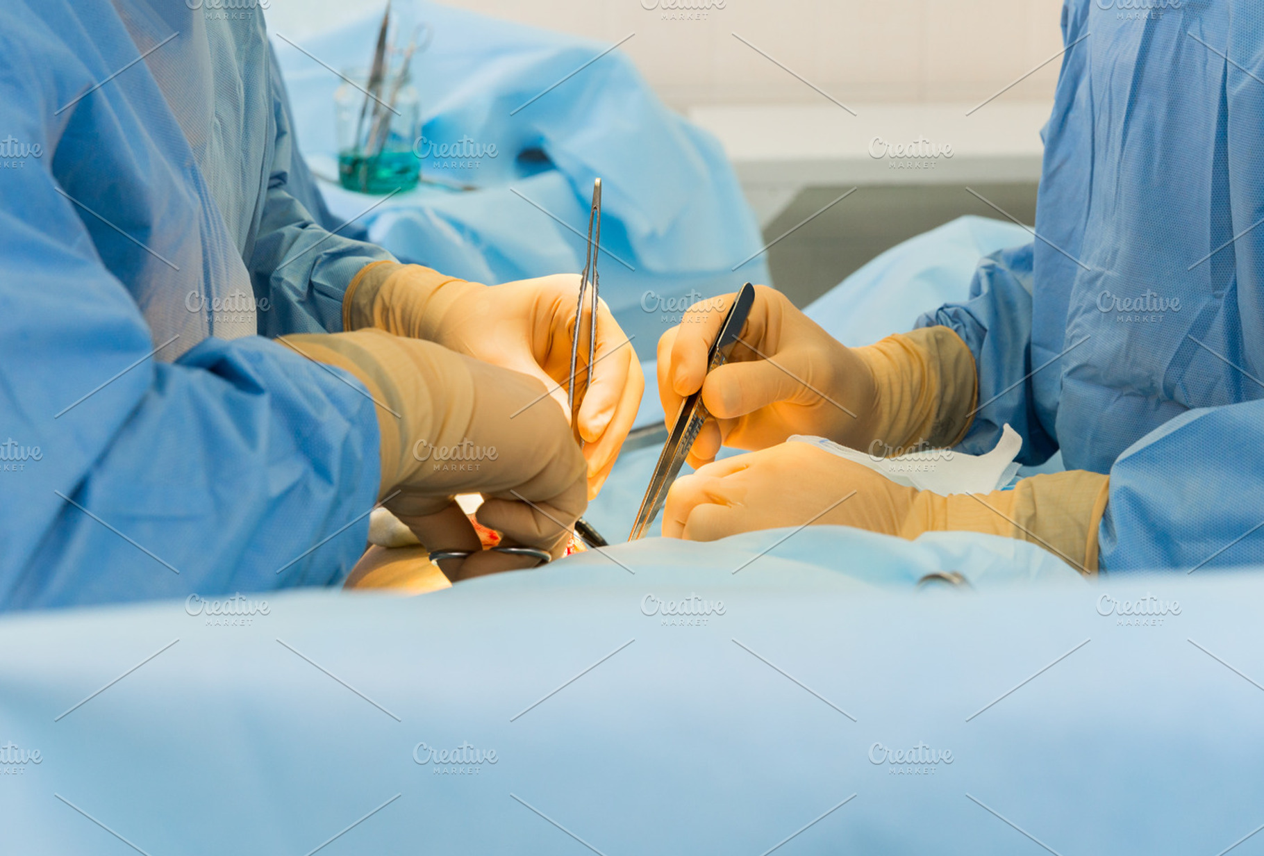Surgeons Hands
