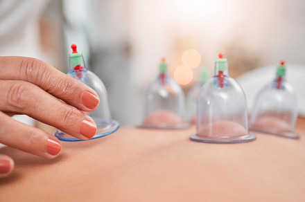 Cupping therapy, hands and spa, healthcare or clinic wellness, blood healing and skin care zoom. Professional, expert and physical therapy worker with plastic vacuum at zen spa for holistic treatment, a Photo by Peopleimages.com