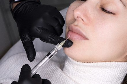 Lip augmentation featuring augmentation, lip, and procedure, a Health & Medical Photo by Elena Vagengeim