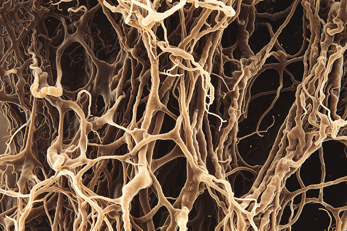 72 Microscopic Fungi Backgrounds, a Background Graphic by h.utomo (Photo 20 of 72)