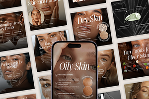 Skin Coach Instagram Templates