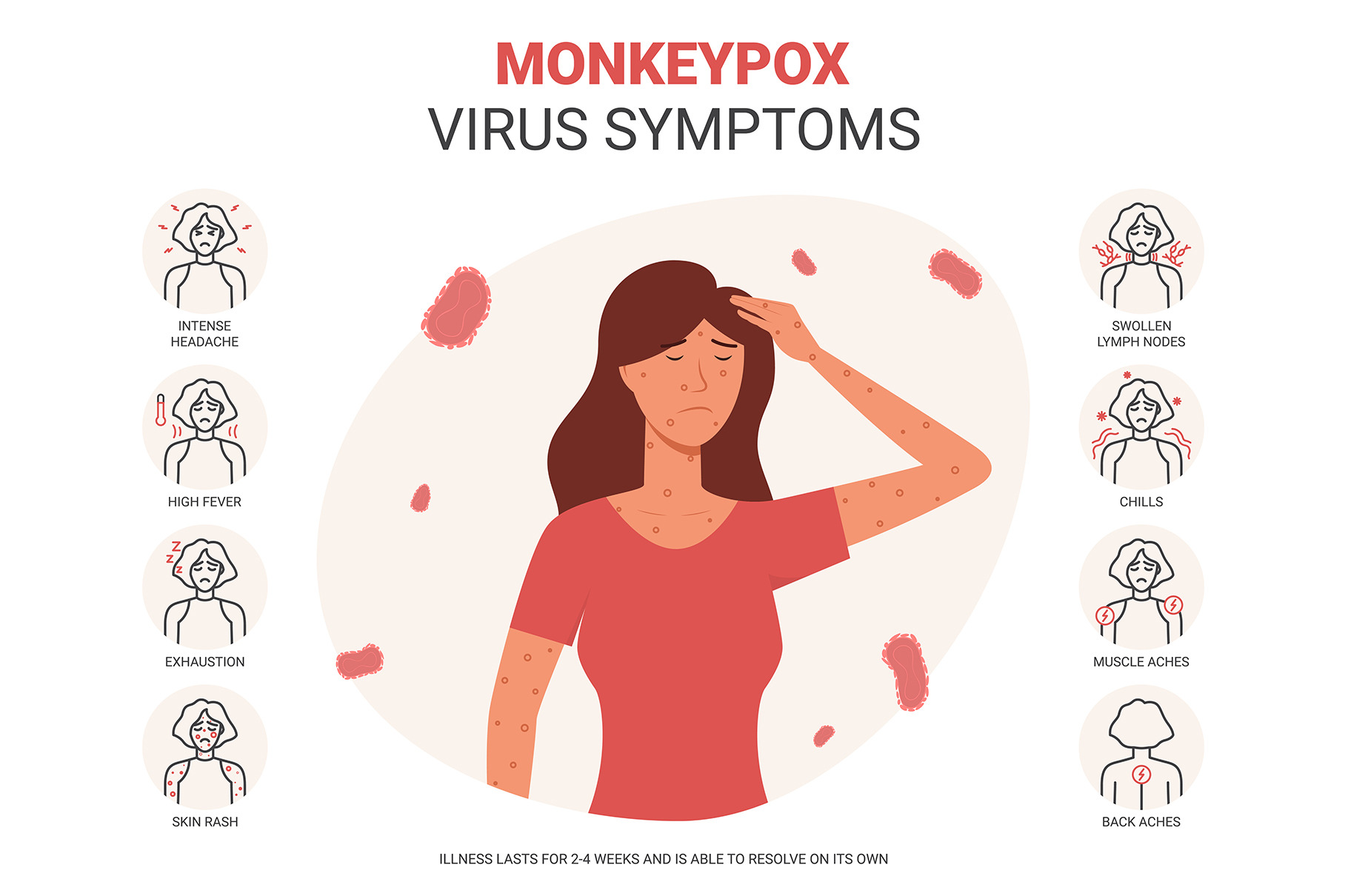 Banner with monkeypox virus symptoms, an Animal Illustration by Andrey ...