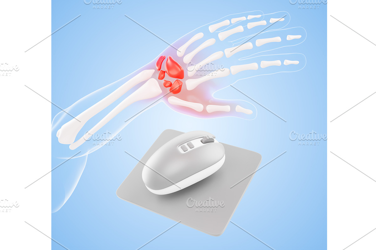 3d wrist pain - arm hand bones with, a Healthcare Illustration by Marozhkastudio