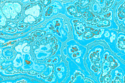 20 turquoise textures 64 Megapixel, a Texture Graphic by tkdesign (Thumbnail 3 of 20)
