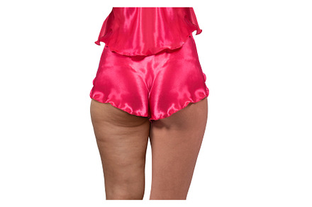 Woman's thighs and buttocks with, a Health & Medical Photo by Jan Jack Russo Media