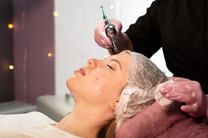 Oxygen epidermal peeling, a Health & Medical Photo by Elena Vagengeim