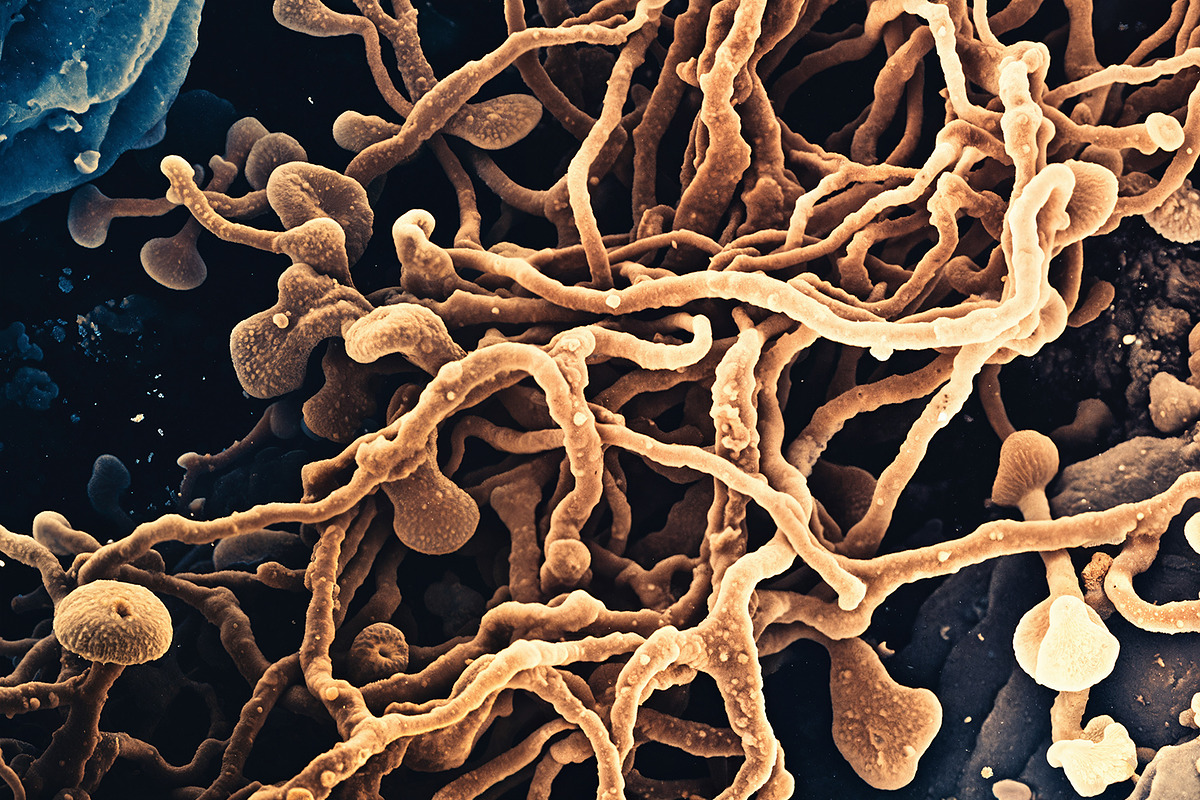 72 Microscopic Fungi Backgrounds, a Background Graphic by h.utomo (Photo 7 of 72)
