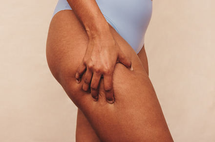 Closeup of an anonymous woman grabbing her thigh in a studio, a Person Photo by Jacob Lund
