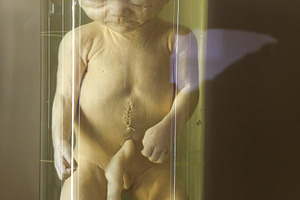 Human fetus 7 th month in glass container with formalin, a School & Education Photo by Bepslabor