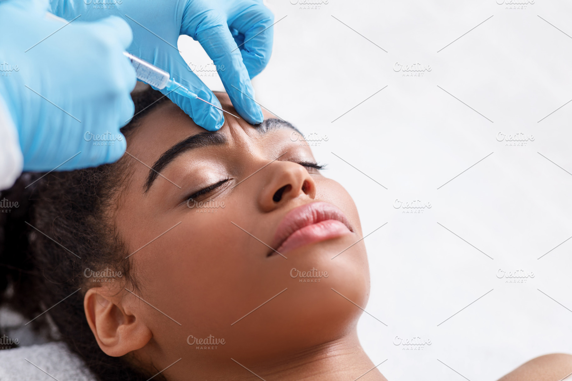 Young black woman receiving botox in, a Photo by Prostock-Studio