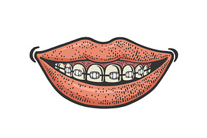 Dental Braces Smile Color Sketch