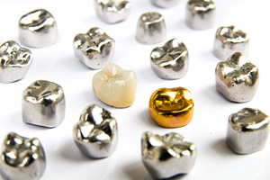 Dental ceramic gold and metal tooth crowns on white background isolated