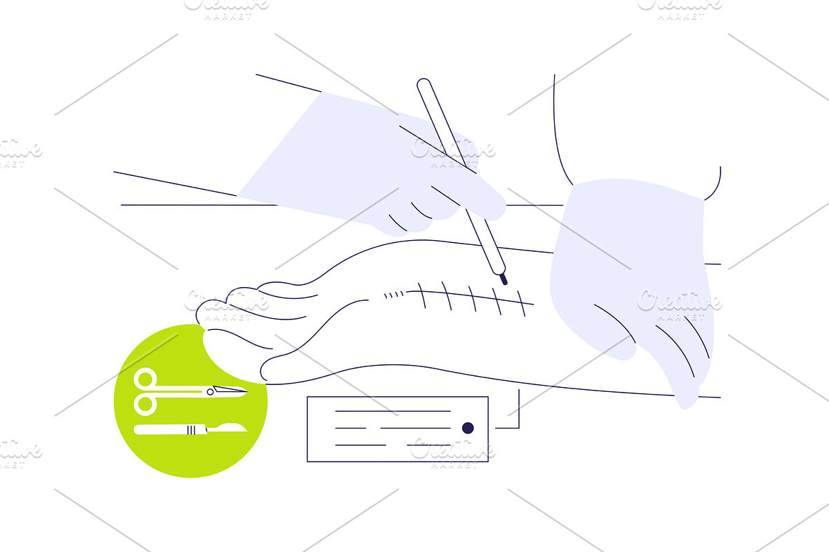 Hand surgery abstract concept vector, a Healthcare Illustration by Visual Generation