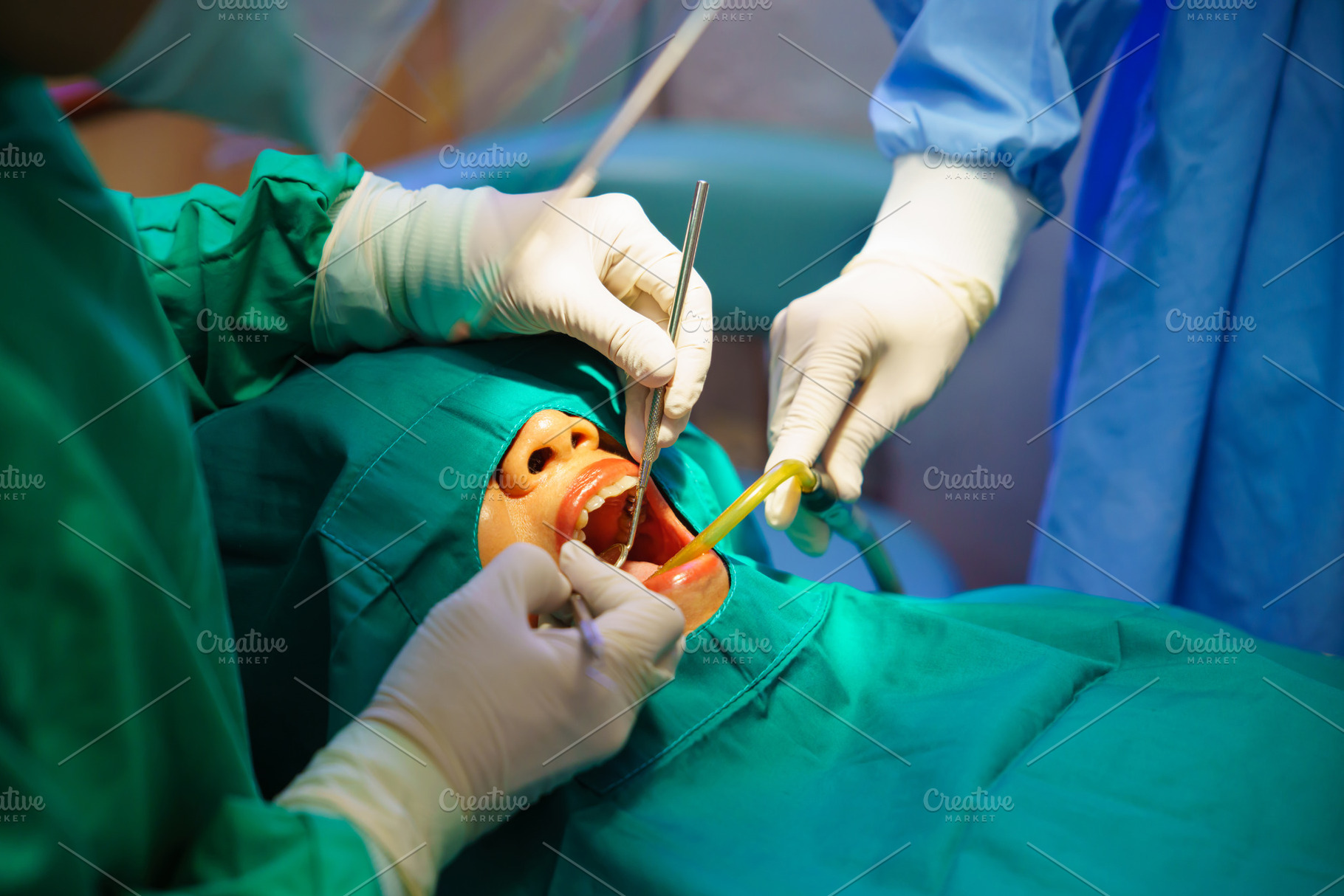 Dentist at work or Concentrated specialist removing tooth stone, a Health & Medical Photo by Casanowe-studio