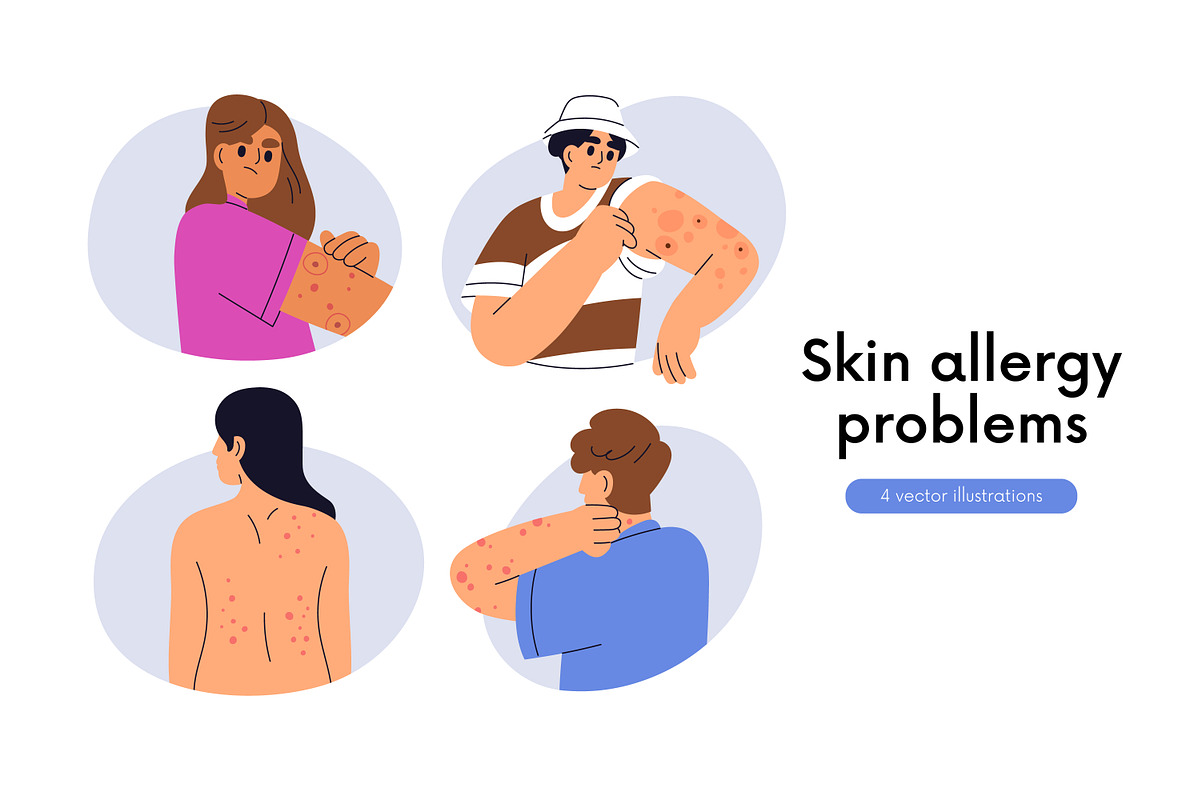 Itch, allergy, rash on skin set, a Person Illustration by Good Studio (Photo 1 of 3)