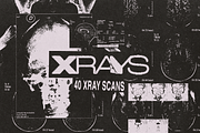 X-Rays Image Pack, a Health & Medical Photo by Design syndrome (Thumbnail 5 of 5)