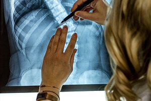 Doctor with patients X-Ray