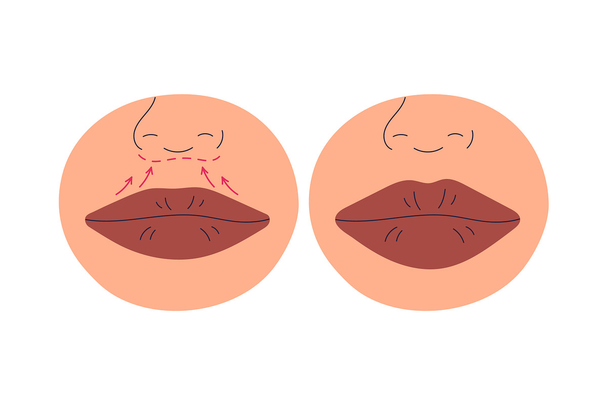 Plastic surgery in beauty clinic set, a Healthcare Illustration by Good Studio (Photo 7 of 12)
