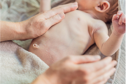 The newborn's skin is peeling. Mom