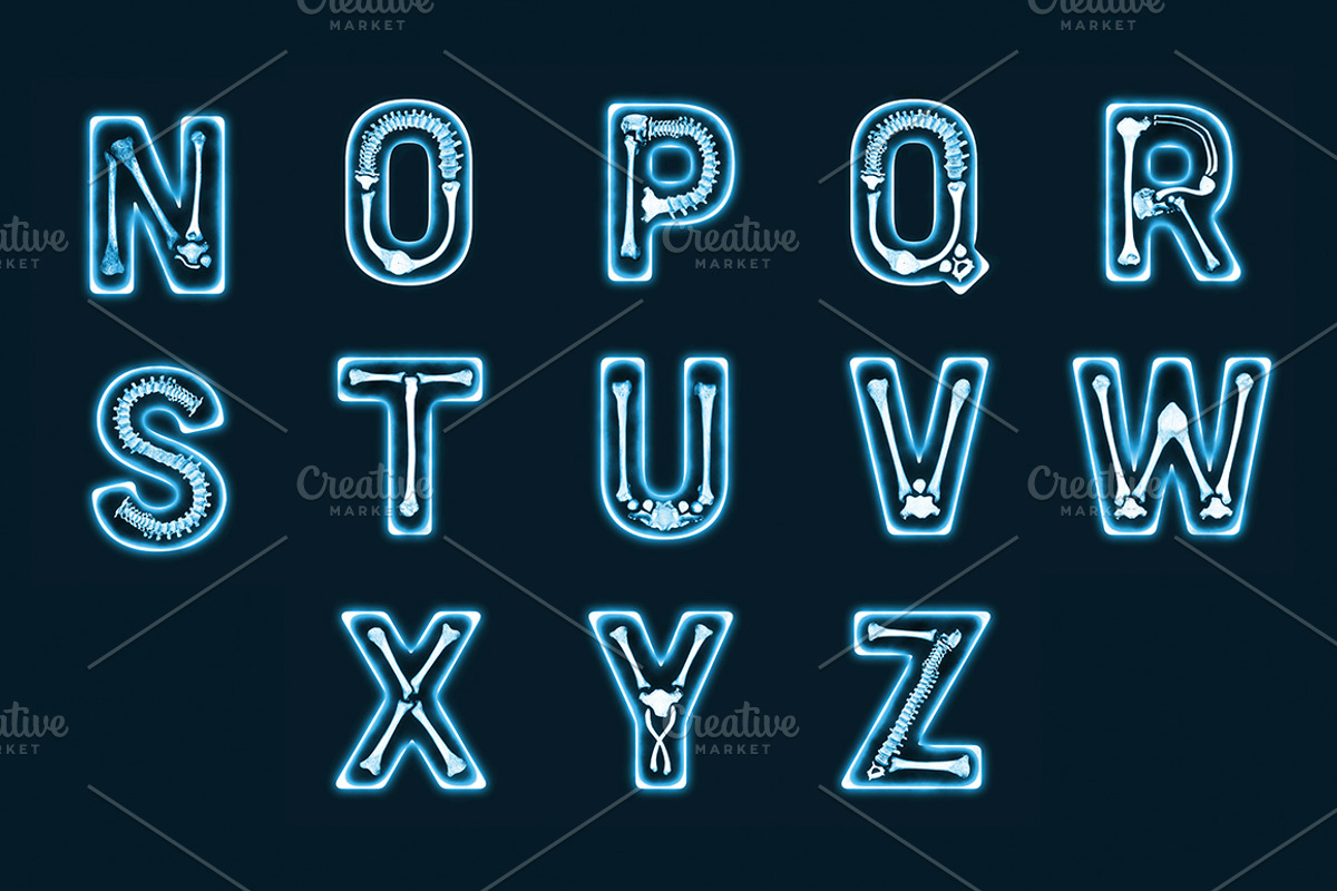 The X-Ray Type preview 4
