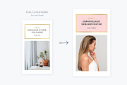 Instagram Stories Gold | CANVA, a Social Media Template by Poego Social (Thumbnail 3 of 12)
