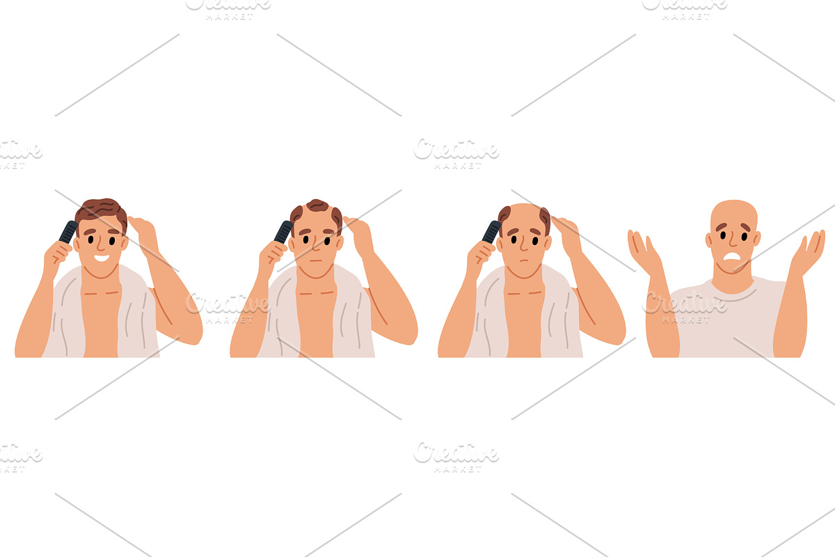 Baldness stages. Hair loss process, a Person Illustration by Vectorbuum