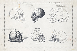 Craniometry