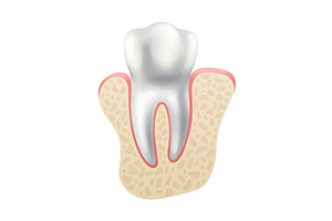 Dental implant. Medical educative, an Object Illustration by the8monkey