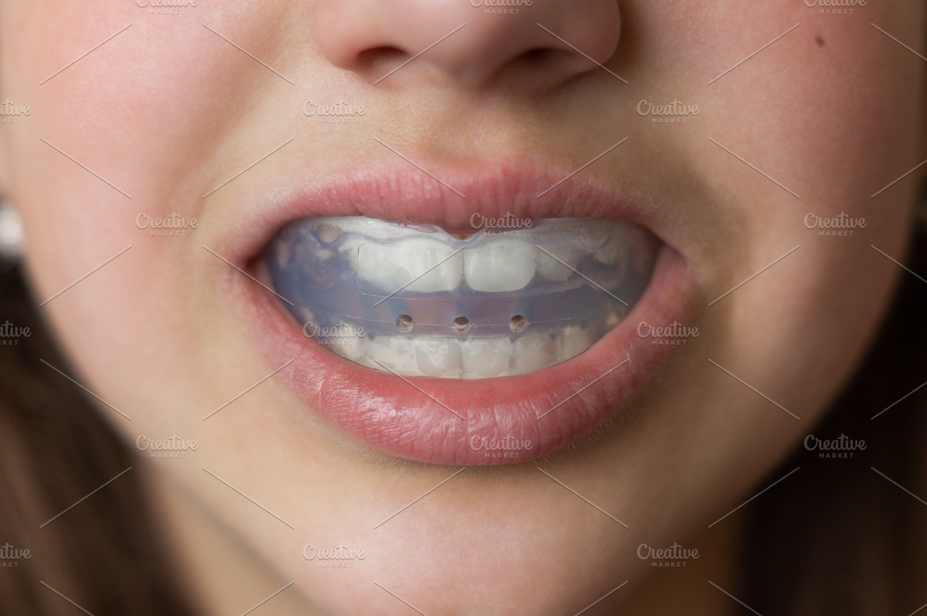 Mouth guard for teeth, a Health & Medical Photo by Nastya_Velko