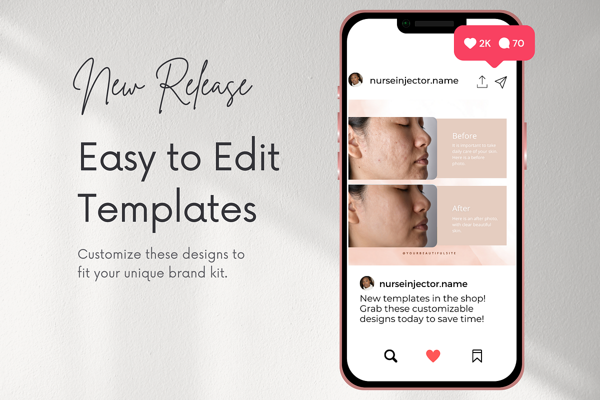 Botox & Esthetician Canva Templates, a Social Media Template by NataliesBox (Photo 9 of 13)