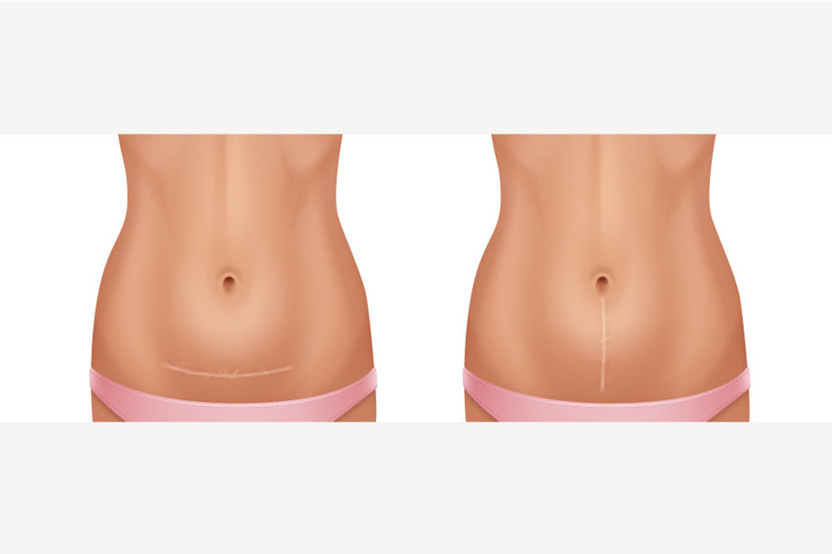 Scars Set, a Healthcare Illustration by Zonda (Photo 6 of 13)