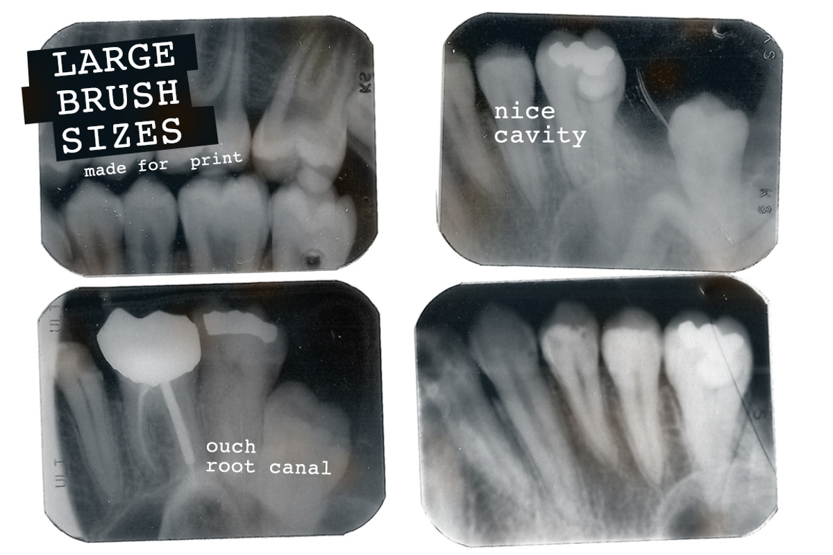 Dental X-ray Brushes preview 4