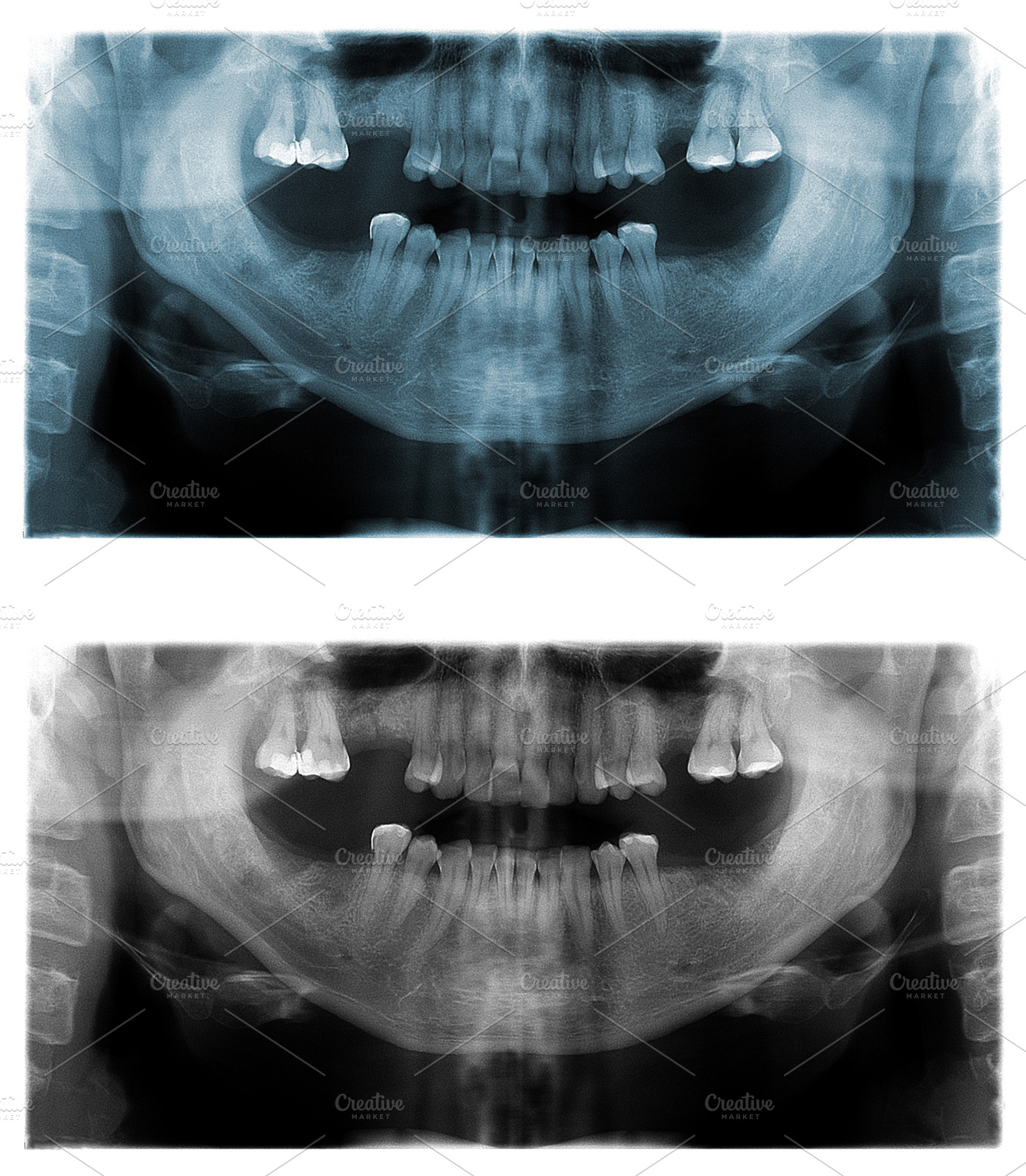 Panoramic dental X-Ray images, a Health & Medical Photo by Vector Tradition