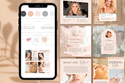 Beauty Botox and Filler Instagram, a Social Media Template by FNDE_DESIGNS1368 (Thumbnail 3 of 6)