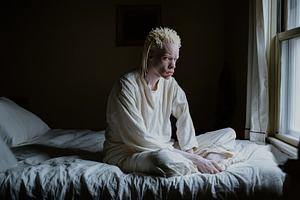 Albino man with dreadlocks sits cont, a Photo by Iftikhar Alam