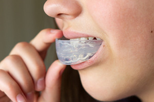 Children's orthodontics