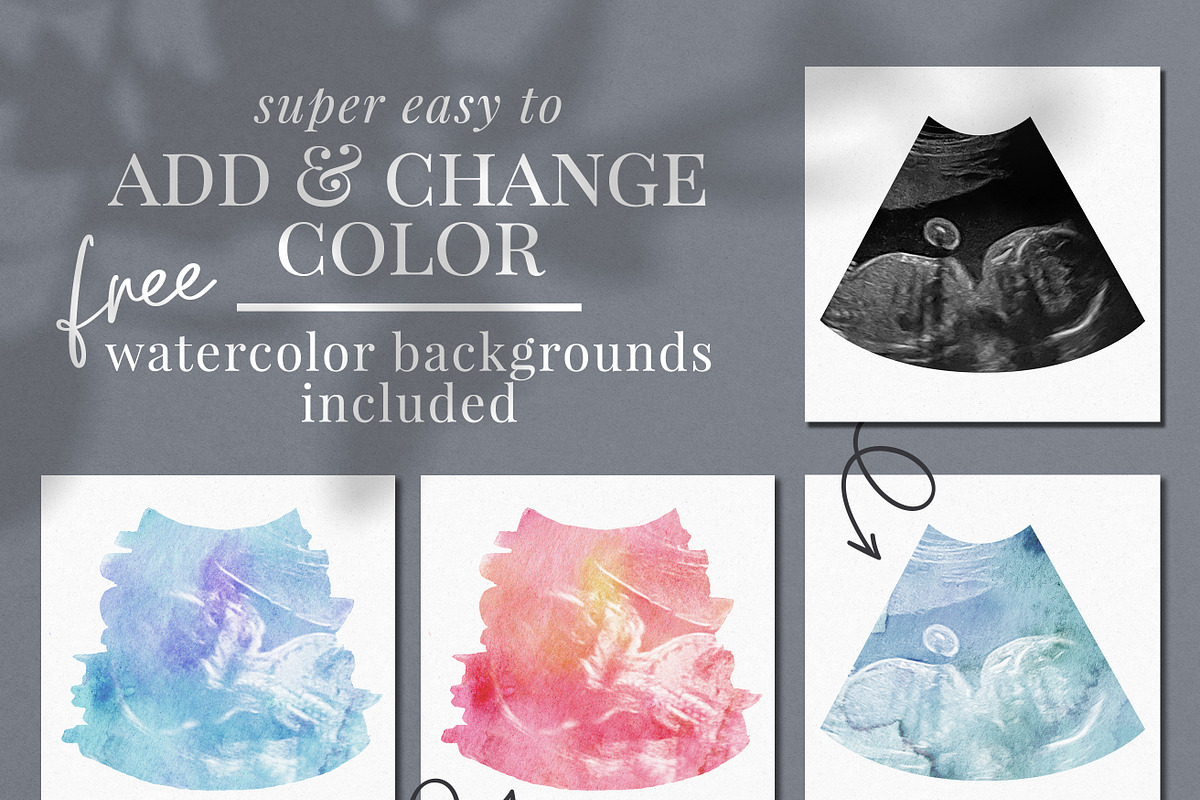 Watercolor ultrasound photomasks, a Layer Style Add-On by BrownLeopard (Photo 4 of 11)