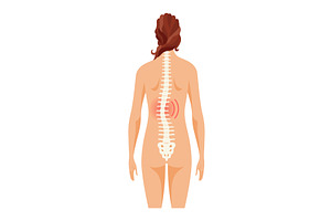 Scoliosis affecting, an Object Illustration by Things for designers
