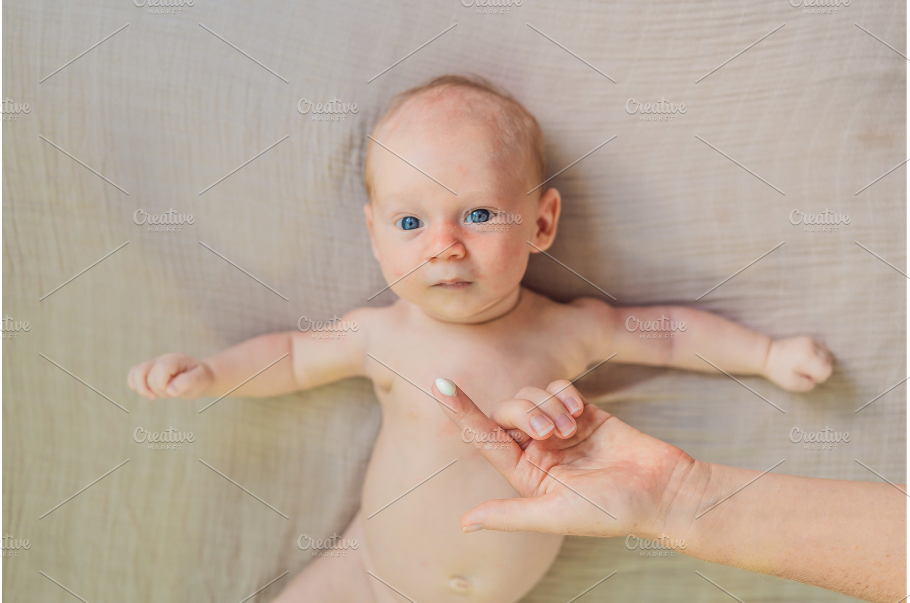 Mother applying anti-rash cream on, a Health & Medical Photo by Elizaveta Galitskaya
