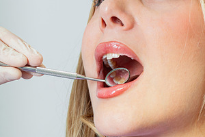 Dentist examining patient's teeth with dental mirror and explorer, a Health & Medical Photo by Antonio Gravante Market