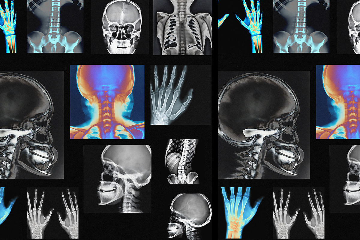 X-RAY SCANS, a Texture Graphic by secret-cache (Photo 2 of 3)
