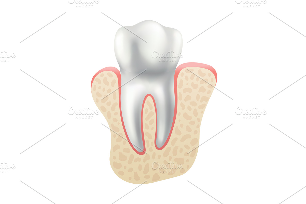Dental implant. Medical educative, an Object Illustration by the8monkey