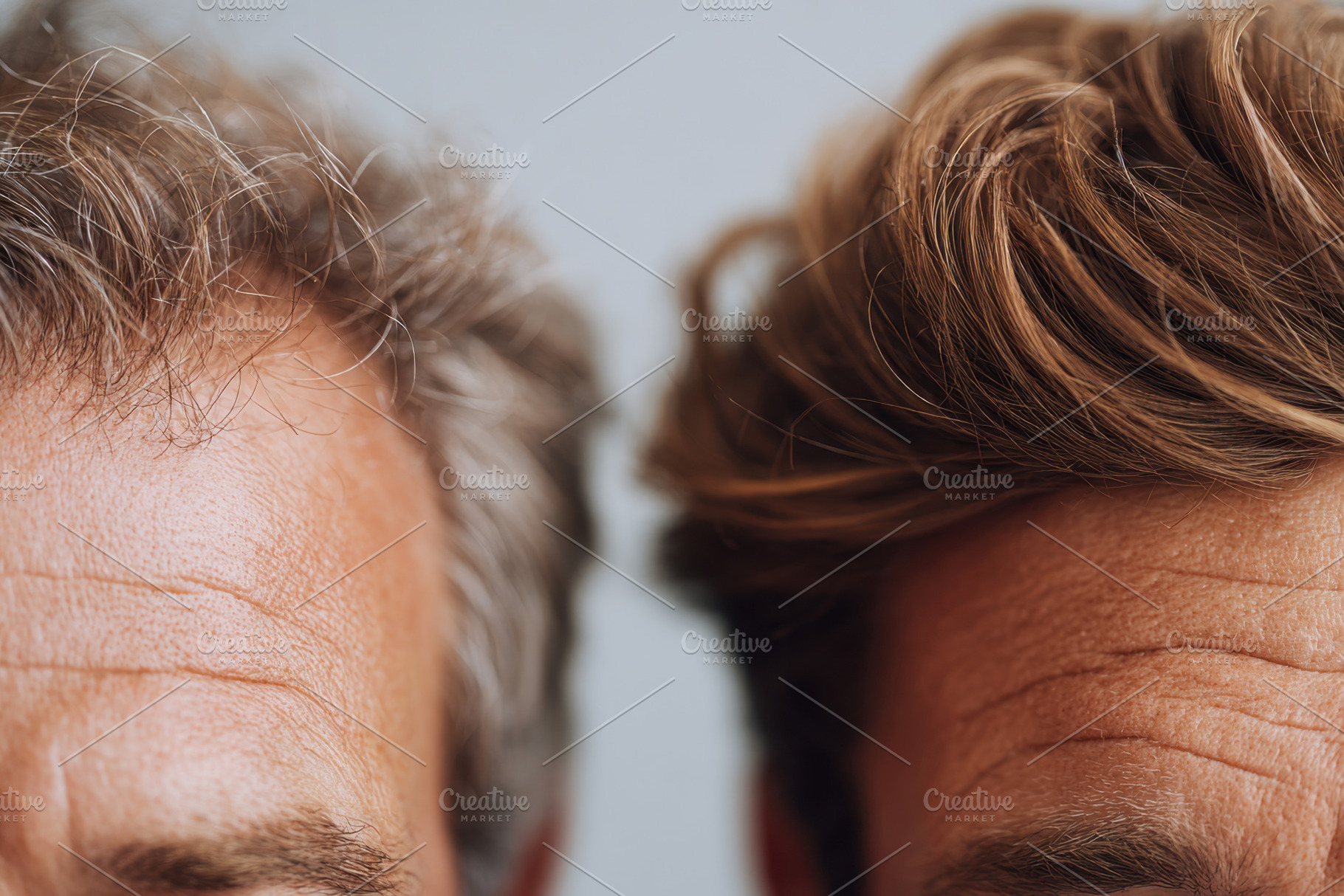 Comparison of Thinning and Thick Hair on Men's Heads, a Health & Medical Photo by AlyaAnd