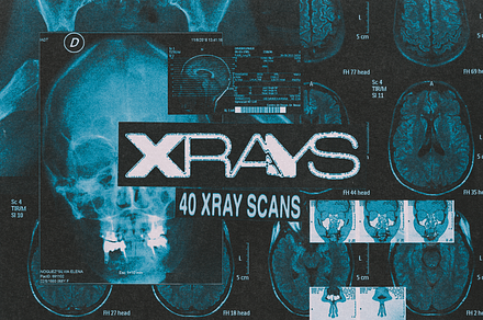 X-Rays Image Pack, a Health & Medical Photo by Design syndrome