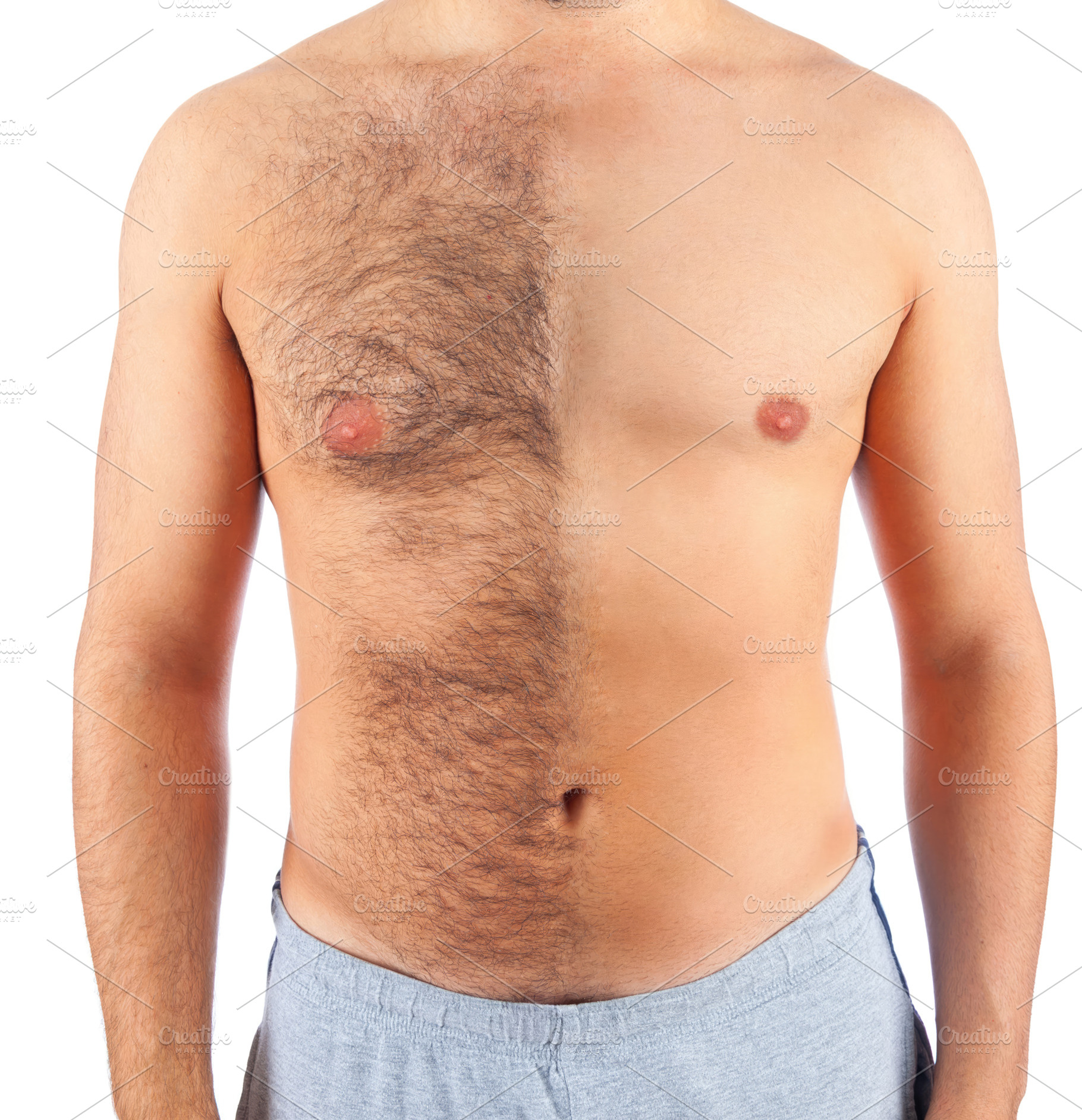 Man showing his chest before and after hair removal treatment, an Abstract Photo by Antonio Gravante Market