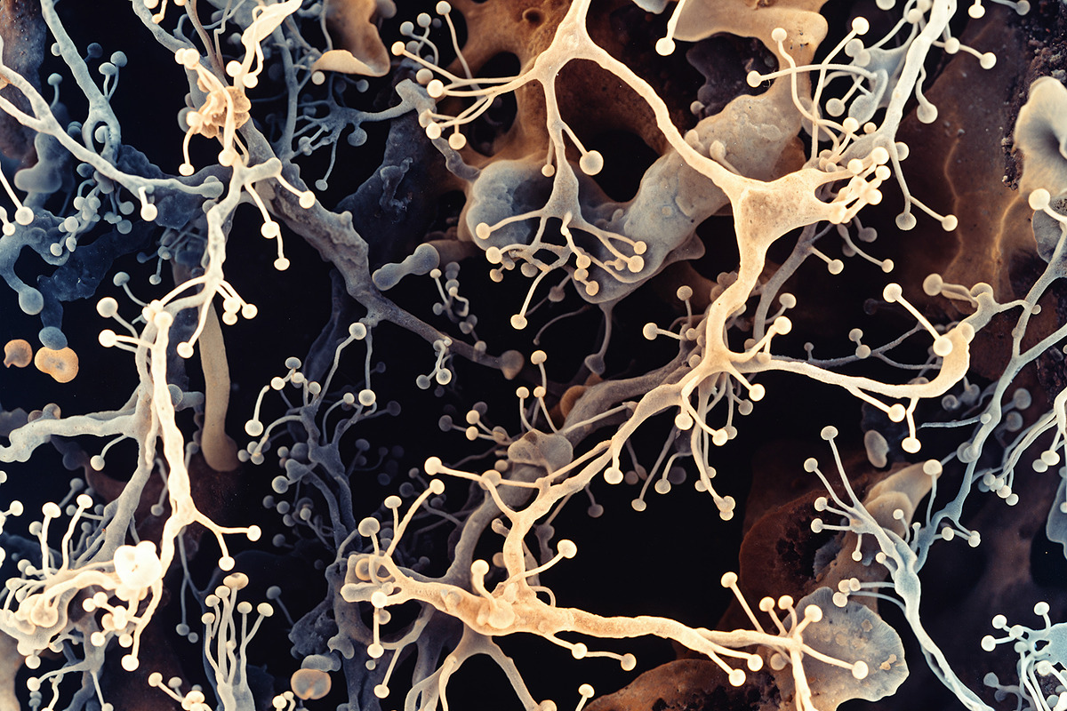 72 Microscopic Fungi Backgrounds, a Background Graphic by h.utomo (Photo 10 of 72)
